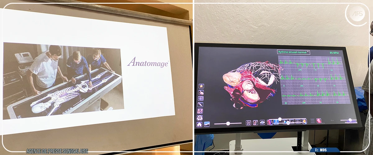 L’université Assane Seck a acquis une table d’anatomie virtuelle