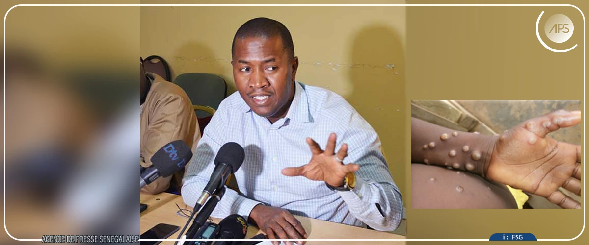 Mpox : à Kolda, la direction régionale de la Santé réactive son dispositif de surveillance des frontières