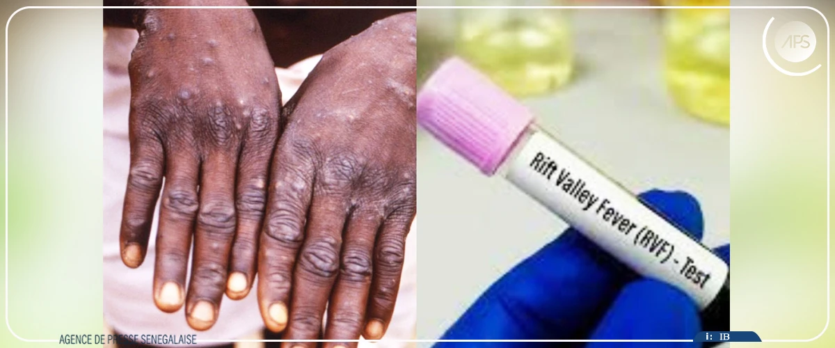 Un premier cas de fièvre de la vallée du Rift enregistré à Fatick