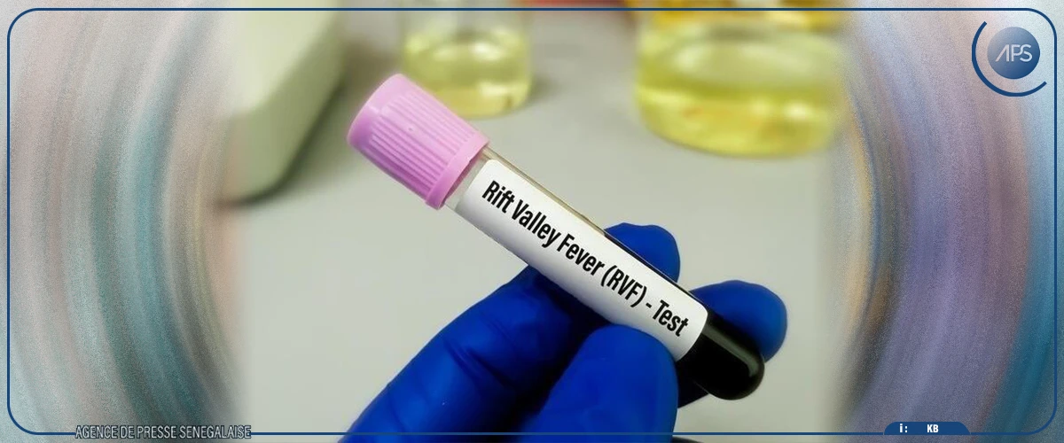 Un premier cas de fièvre de la vallée du Rift enregistré à Kaffrine