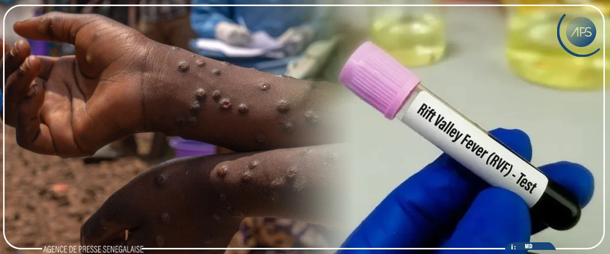Rétro 2025 : les épidémies de mpox et de fièvre de la vallée du Rift ont secoué le système de santé