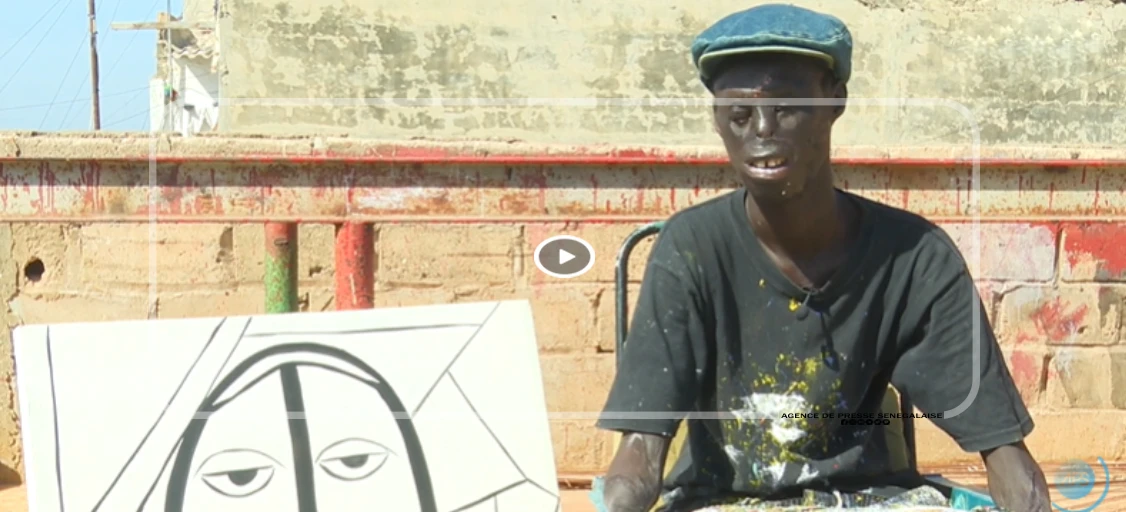 Brûlé par la vie, illuminé par l’art : Guem Guem, un survivant qui peint l’espoir