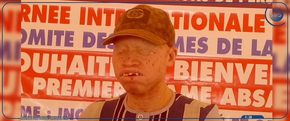 À Ziguinchor, la Première dame Absa Faye soutient l'autonomisation des femmes en situation de handicap