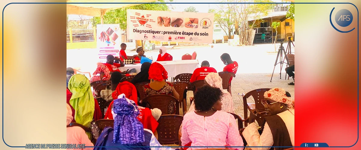 Hémophilie : l’accès aux facteurs de coagulation est le principal défi de la prise en charge, selon un médecin