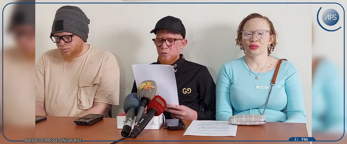 Une association alerte sur les difficultés persistantes des personnes atteintes d’albinisme