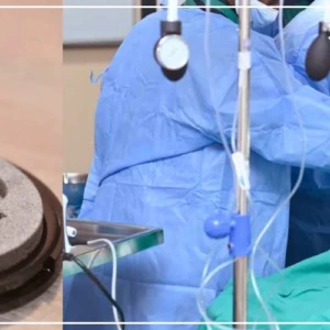 Implantations de pacemakers sans sonde : l'Hôpital Idrissa Pouye en pointe de l'innovation en Afrique de l'Ouest