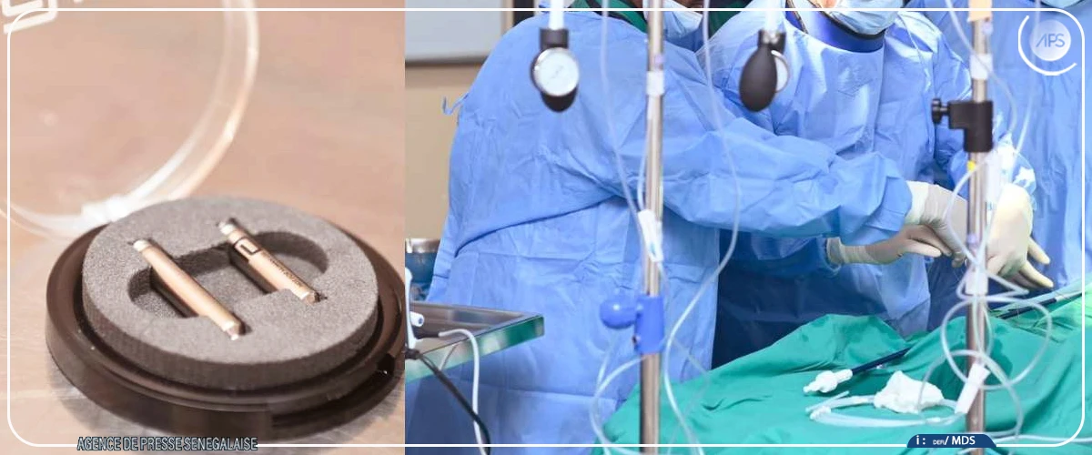 Implantations de pacemakers sans sonde : l’Hôpital Idrissa Pouye en pointe de l’innovation en Afrique de l’Ouest